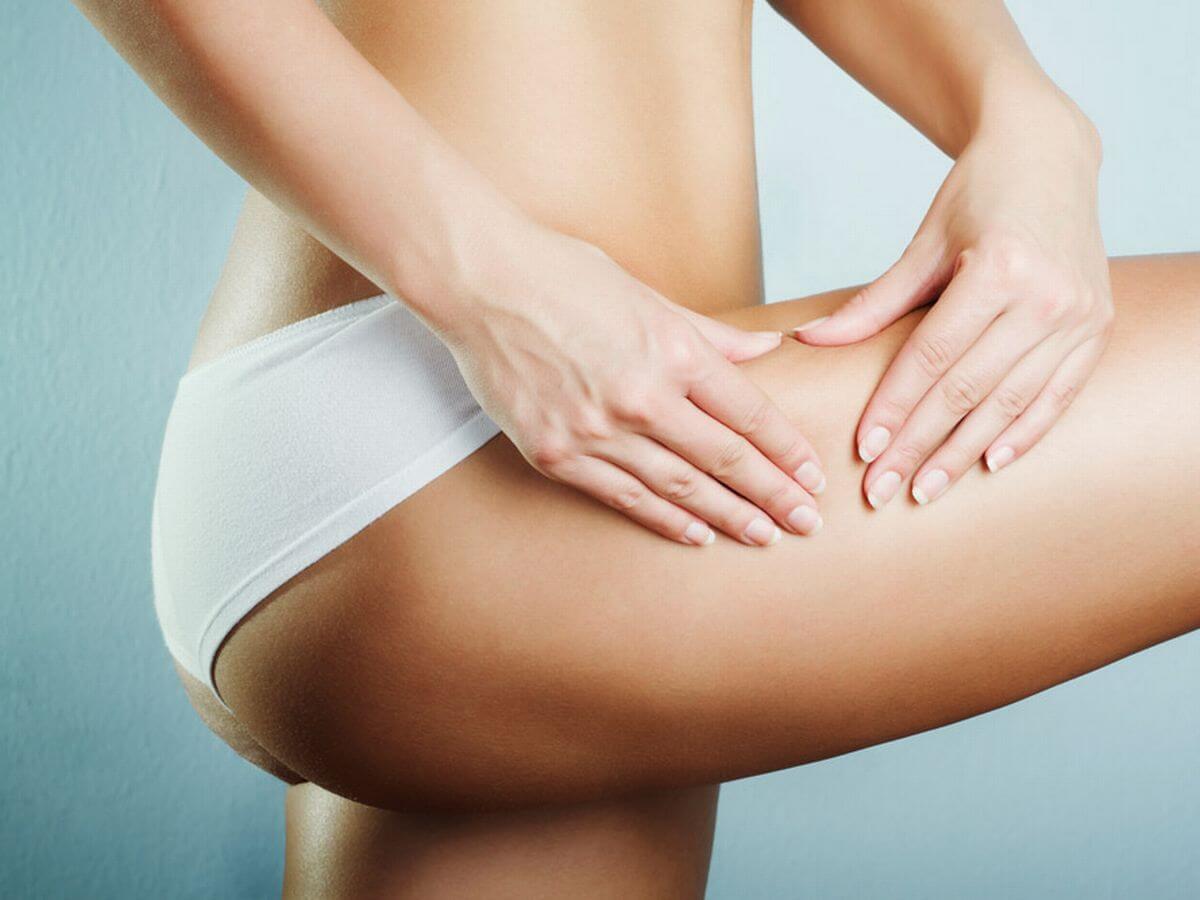 7 Effective Ways To Tackle Stretch Marks